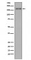 MSH6 Antibody